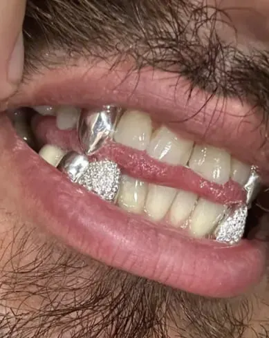 Unik Grillz 2