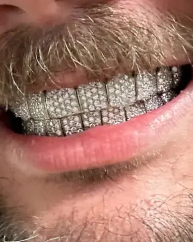 Unik Grillz 3