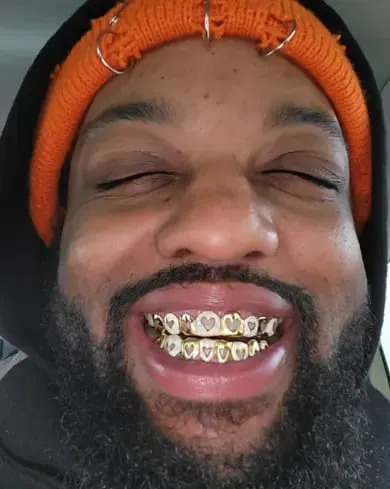 Unik Grillz 6