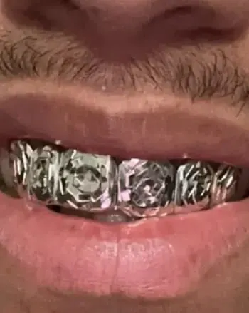 Unik Grillz 7